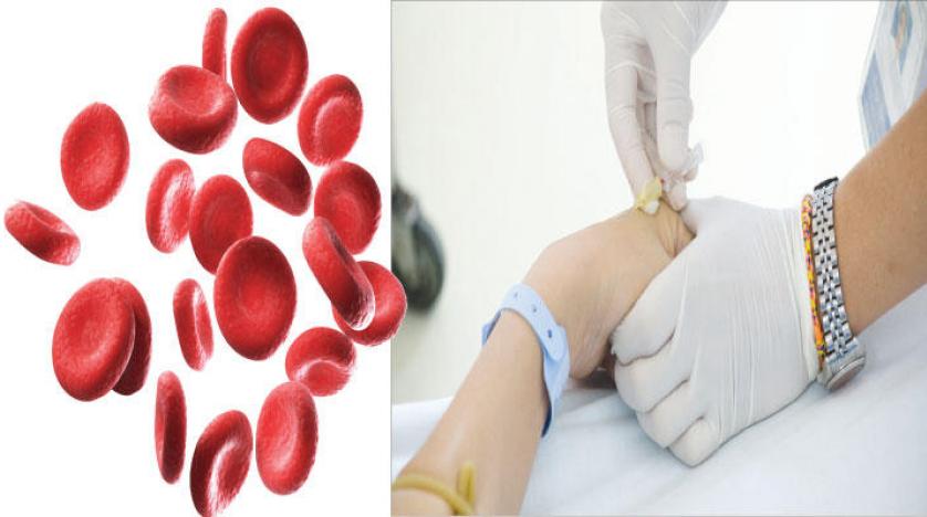 ما هو تحليل Ferritin - علاج نقص مستوي الحديد في الجسم 2404 6