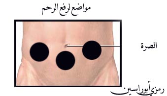 اماكن الحجامه للحمل بالصور - عندك عقم شوفي العلاج والحل السريع 2455 1