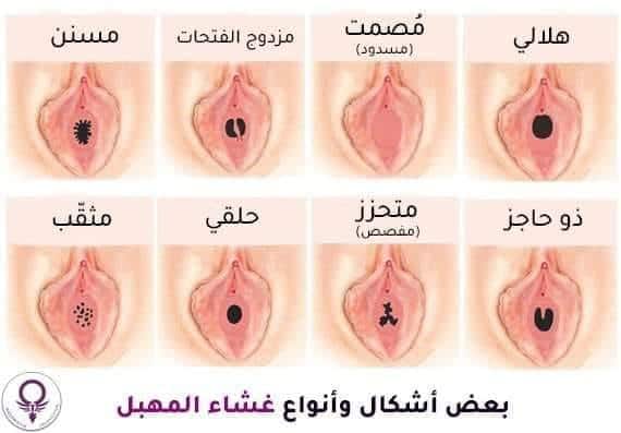 اشكال المهبل الطبيعي - انواع المهبل و شكله 4260 8