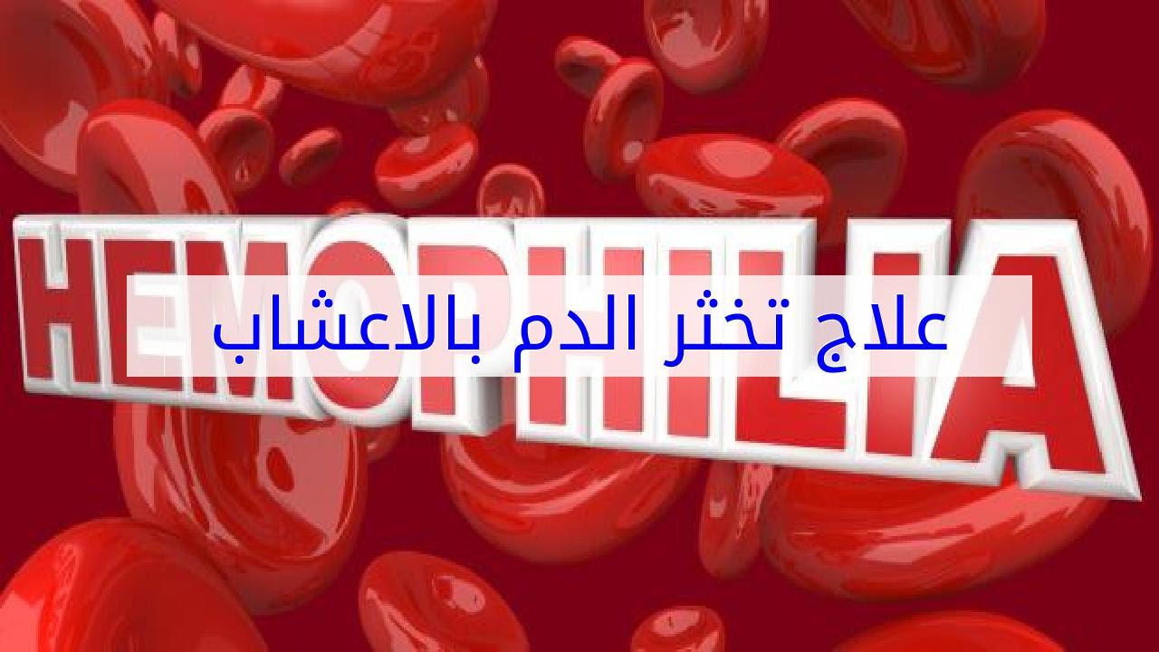 علاج تخثر الدم بالاعشاب - الطب البديل فى علاج تجلط الدم