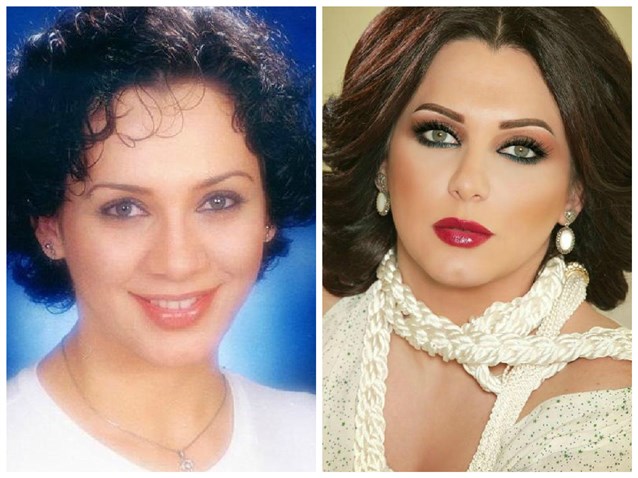 صور الفنانات قبل وبعد التجميل , شاهد كيف تغير الفنانات بعد علميات التجميل