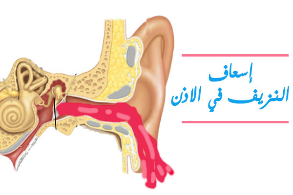 سبب خروج الدم من الاذن - تفسير الطب لنزول الدم من الاذن 2960 1