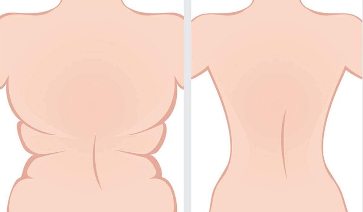 تمارين لازالة دهون الظهر , قولي وداعا لدهون الظهر