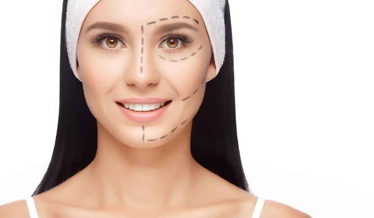 شكل الانف بعد عملية التجميل - انفك مش هيزعجك من دلوقتى 3367 2