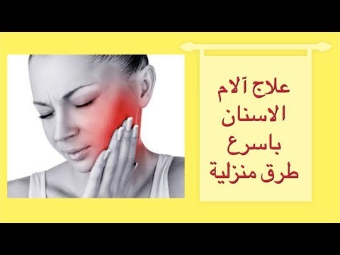 الام الاسنان وعلاجها - افضل طرق لعلاج الالام الاسنان 1835 1