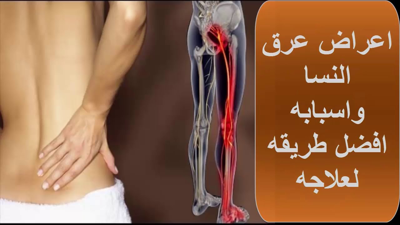 اعراض عرق النسا وعلاجه بالاعشاب , هتتخلصي من الوجع نهائي