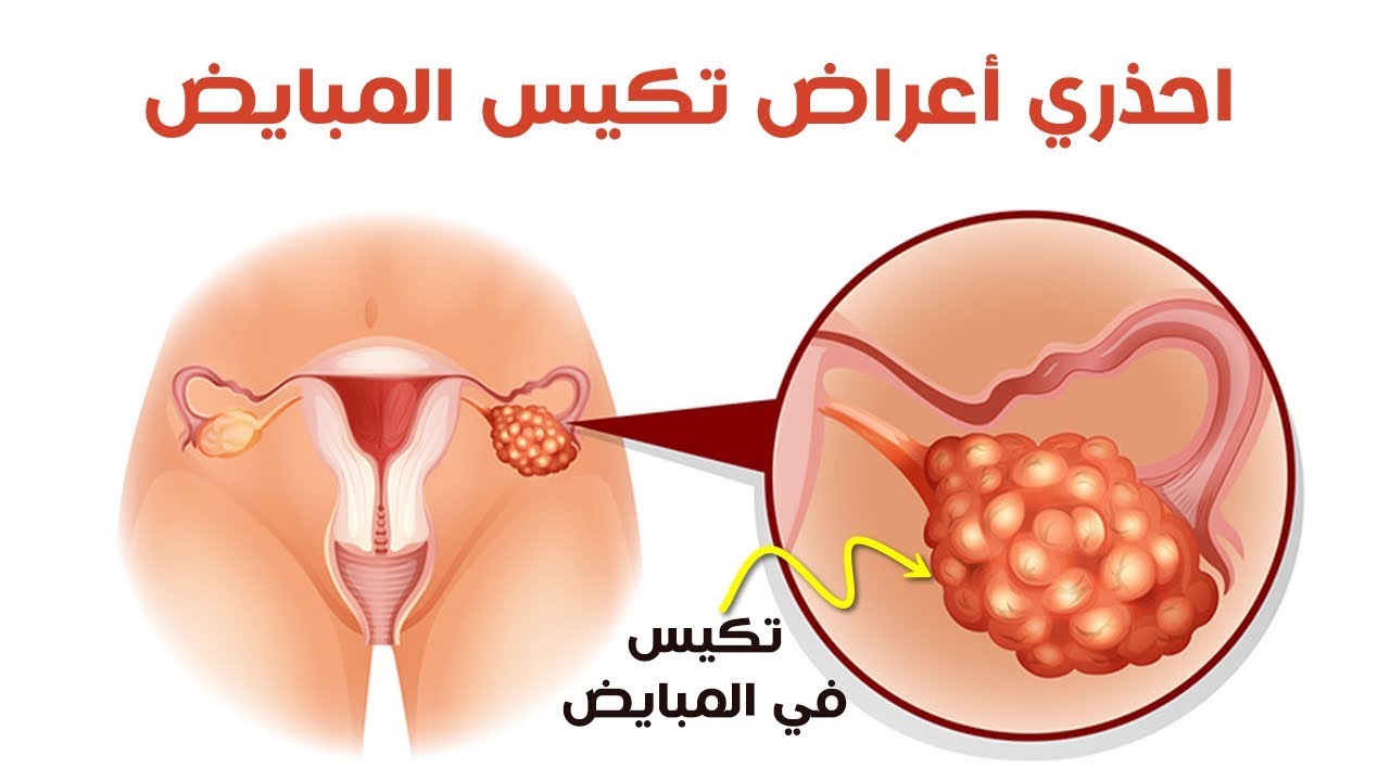 الاهتمام وقت الدوره للمتزوجه - تعرف علي تقلب مود زوجتك 2271 1