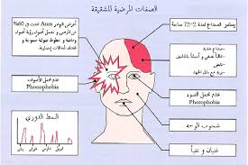 اعراض مرض الشقيقة , خطورة الصداع النصفي