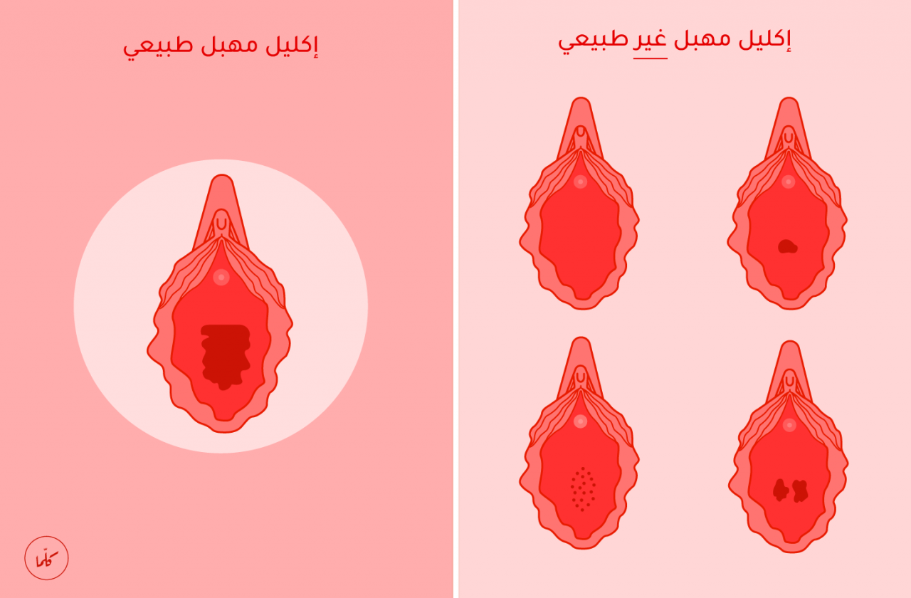 اشكال المهبل الطبيعي - انواع المهبل و شكله 4260 2