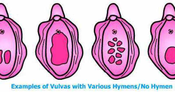 اشكال المهبل الطبيعي - انواع المهبل و شكله 4260 6