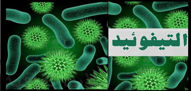 اسباب مرض التيفود , اعراض مرض التيفود واسبابه 