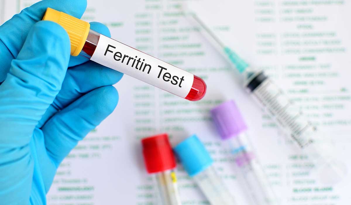 ما هو تحليل ferritin , علاج نقص مستوي الحديد في الجسم